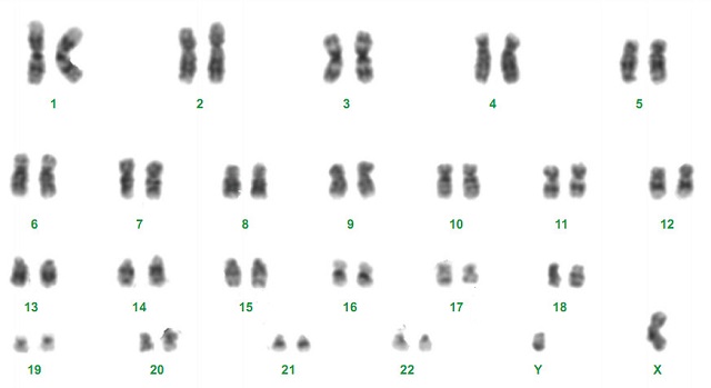 Human Karyotype - 23 chromosomes